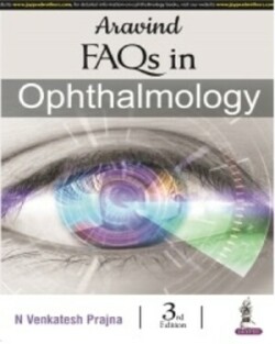 Aravind FAQs in Ophthalmology