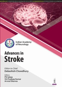 Recent Advances in Stroke