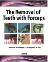 Removal of Teeth with Forceps