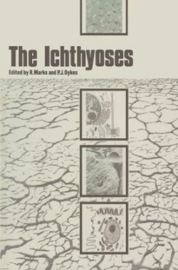 Ichthyoses