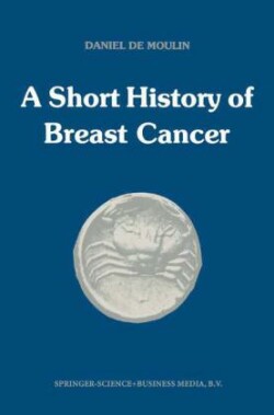 short history of breast cancer