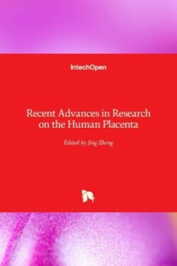 Recent Advances in Research on the Human Placenta