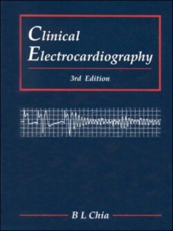 Clinical Electrocardiography (Third Edition)