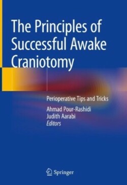 Principles of Successful Awake Craniotomy