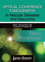 Optical Coherence Tomography in Macular Diseases and Glaucoma: Basic Knowledge