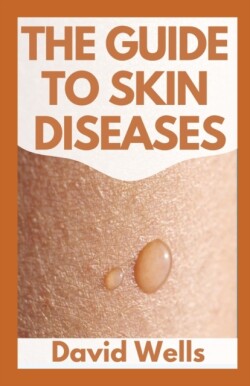 New Guide to Skin Diseases